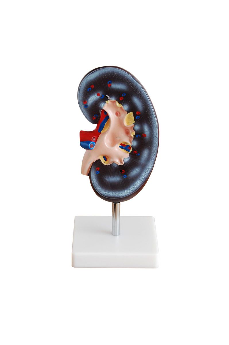 Kidney Model (1 Part) - Urinary System Model (7275164074139)